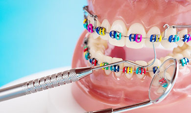 Orthodontic model with colorful metals