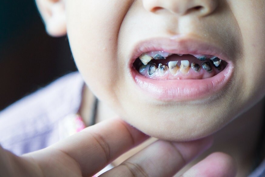Here are some tips from a pediatric dentist at Kakar Dental Group to help y...