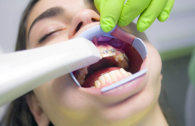 Cosmetic-Dentistry-Tyson