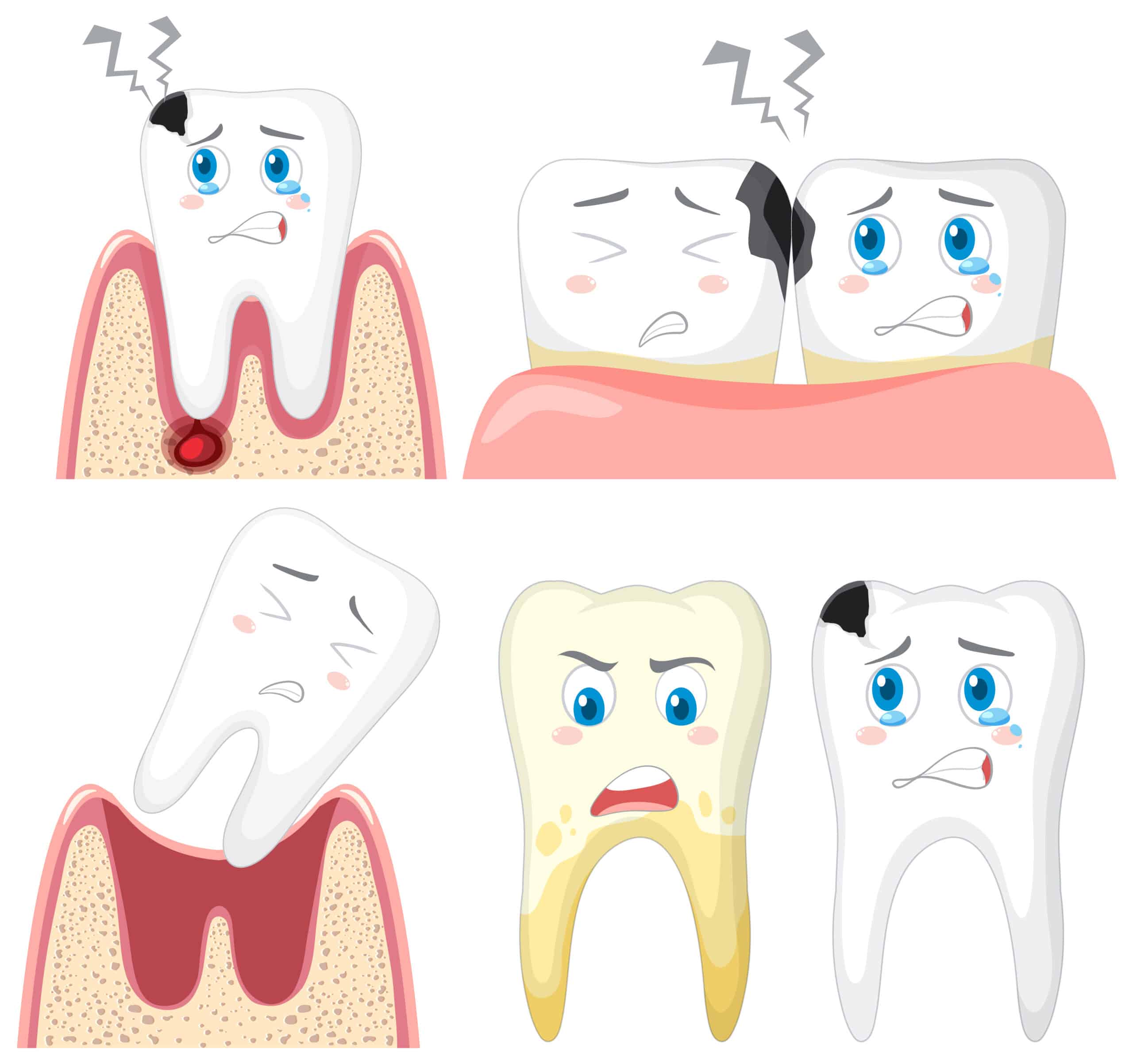 Fixing a chipped tooth can vary depending on the severity of the chip. Here's a general guide on what you can do